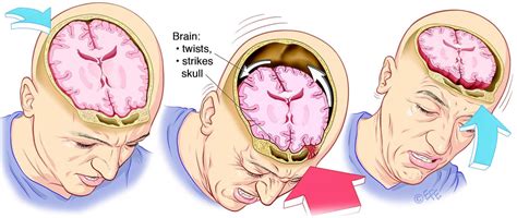 Can You Listen to Music with a Concussion? And Why Does the Moon Smell Like Blue Cheese?