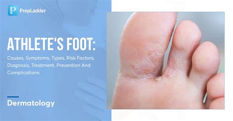 Can You Swim with Athlete's Foot? Exploring the Myths, Risks, and Realities